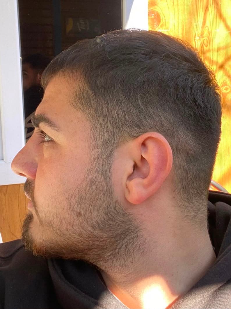 ÖNCE